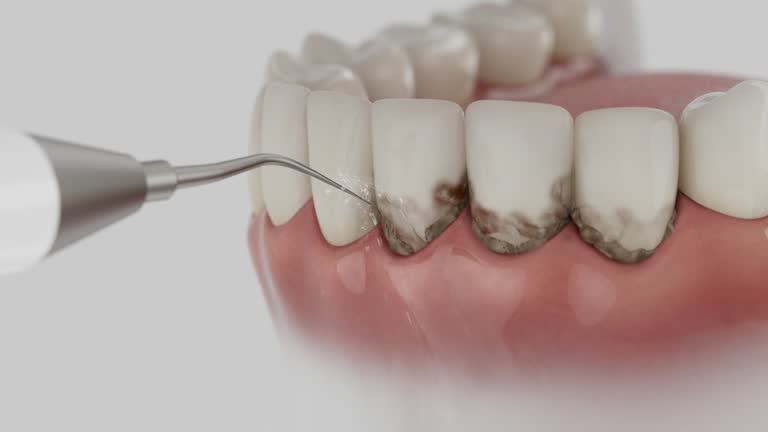 Trusted Dental Crowns And Bridges service in Island Park, NY - Dentist Open Now